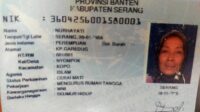 Terkena Tumor, Nurhayati Warga Desa Nyompok Kec Kopo Butuh Bantuan