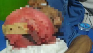 Gara-Gara Minta Rokok Seorang Ayah Di Lebak Dibacok Anak Kandungnya