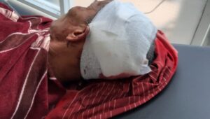 Marah Tanpa Alasan Ke Istri, Suami Di Kab Serang Bacok Tetangga Dan Bakar Rumah Sendiri Lalu Kabur