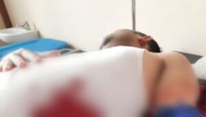 Ada Masalah Pribadi, Tenaga Honorer Di Kab Tanggamus Sabet Sekdis Koperindag Dengan Clurit