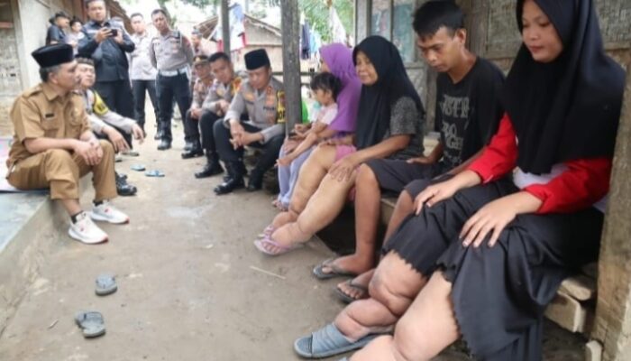 Kapolres Lebak Datangi Penderita Kaki Gajah Di Jagabaya
