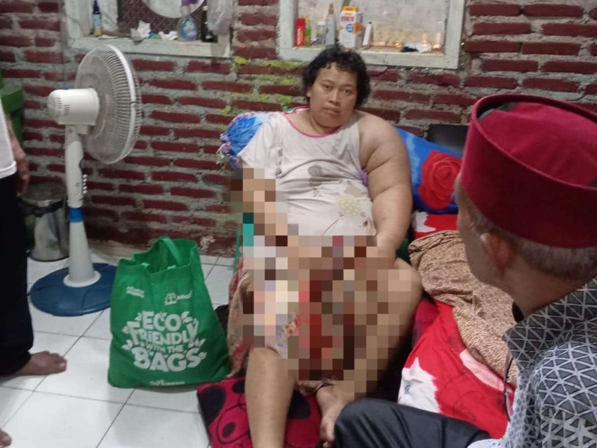 Foto: Santini (41 ) warga Kp Ranca Sadang RT 017/006 Desa Tapos lebih dari 1 tahun menderita sakit kanker payudara dan sudah tak mampu berjalan sehingga perlu bantuan kursi roda.