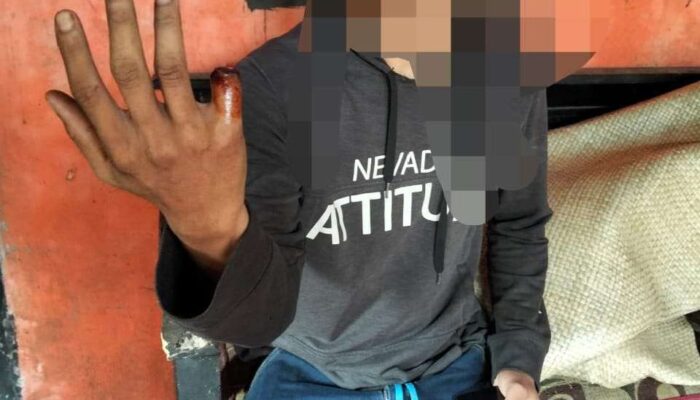 Putus Jari Saat Bekerja, Pekerja Harian di Tangerang Diduga Tak Dapat Santunan dan Tak Terlindungi BPJS